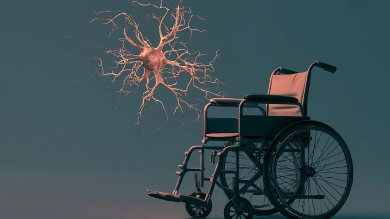 Erweiterte neuronale Überwachung bei der Behandlung von Beckenschwannomen