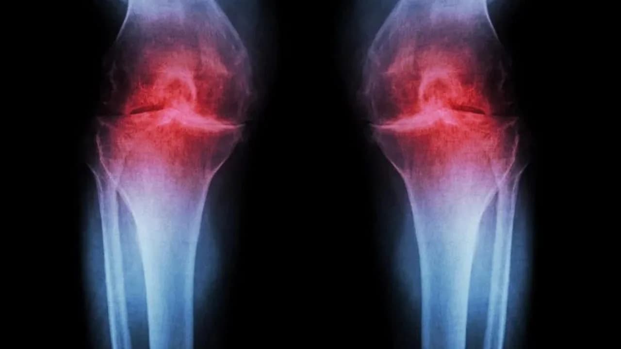 Ultrasonik Technologie kann Kalkablagerungen verhindern, bevor sie entstehen.