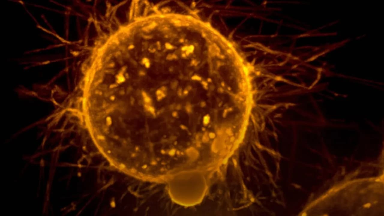Neue Methode bei der Behandlung von Bauchspeicheldrüsenkrebs: Versteckte Tumoren werden vom Immunsystem erkannt