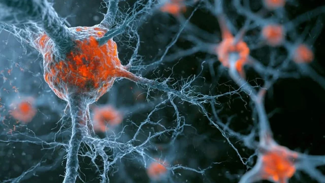 Forscher haben den Ausbreitungsmechanismus des toxischen Proteins bei Alzheimer entdeckt.