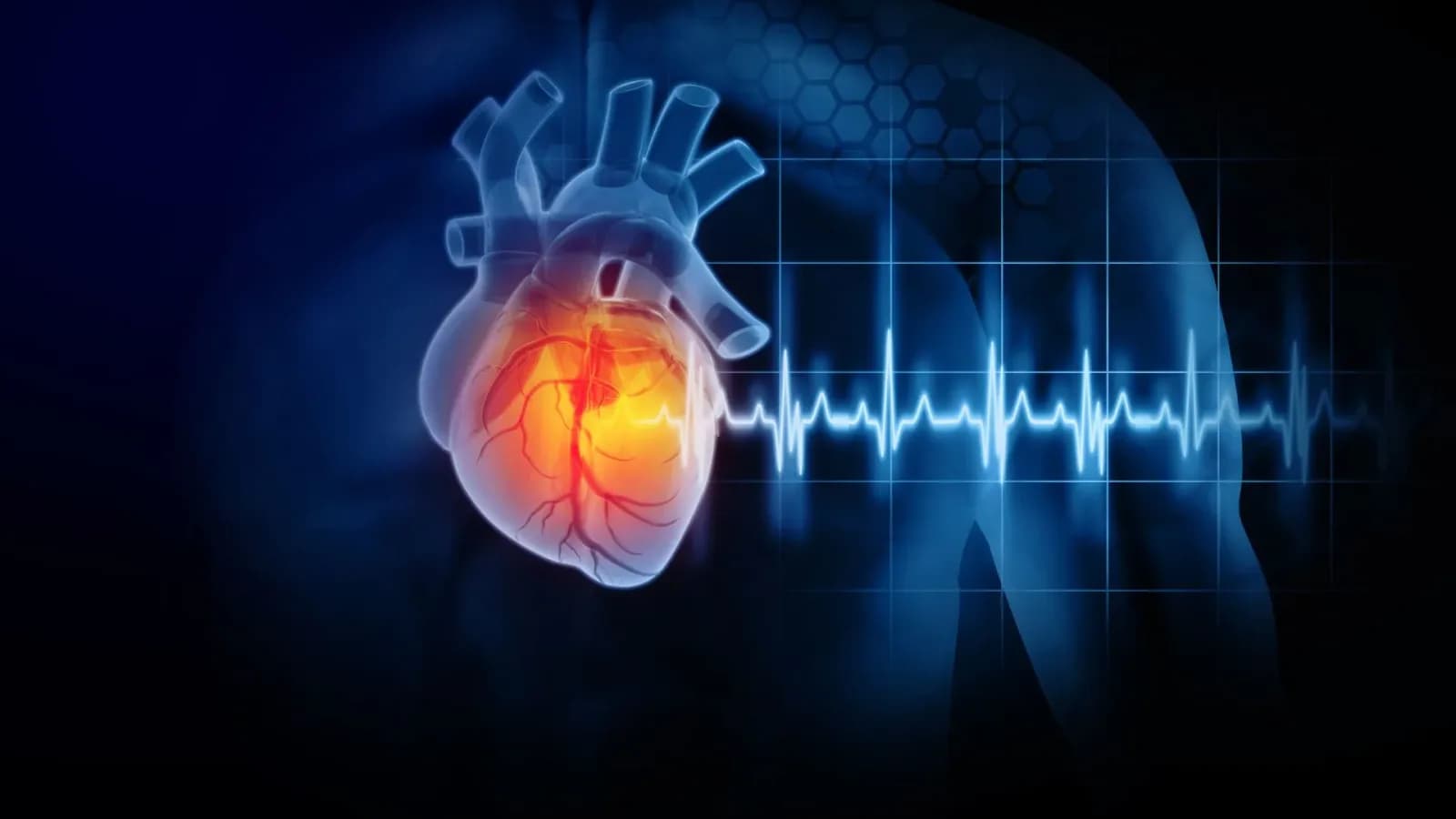 MIT stellt nicht-invasiven Wearable-Schrittmacher vor, der Herzpatienten rettet