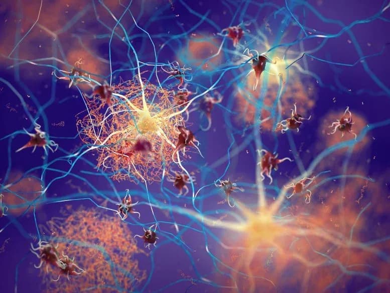Wissenschaftler entdecken entscheidenden Alzheimer-Schwellenwert, der über Demenz entscheidet
