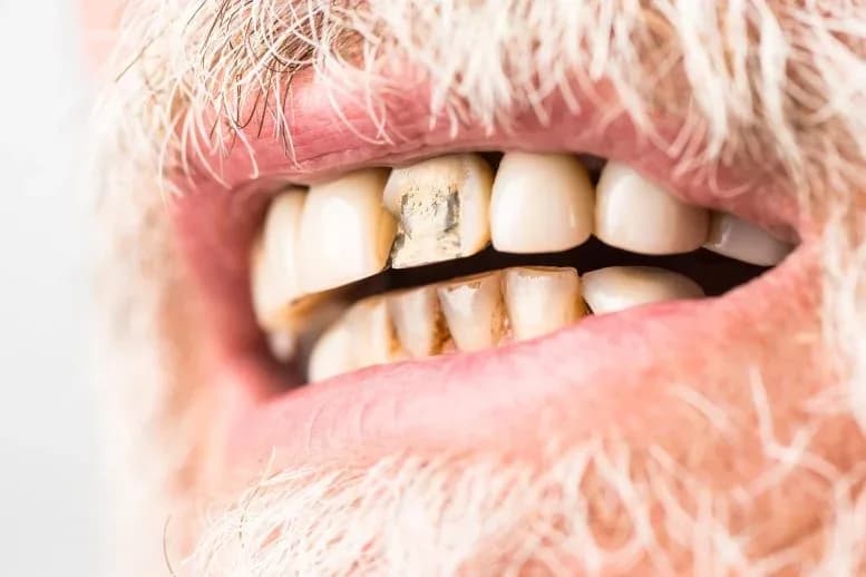 Wissenschaftler entdecken Stammzellen, die Zähne und Knochen nachwachsen lassen könnten