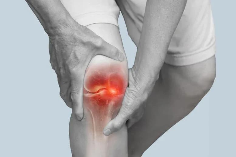 rzte bersehen mglicherweise die eigentliche Ursache anhaltender Arthritisschmerzen
