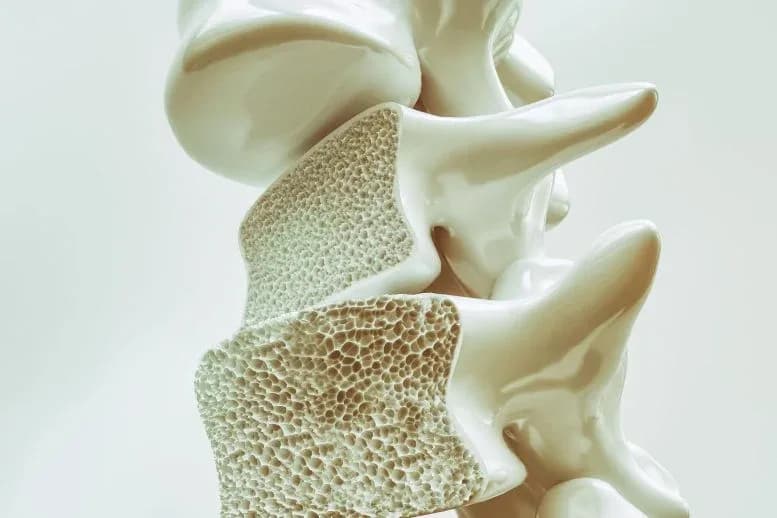 Millionen von Menschen haben Osteopenie, ohne es zu merken – hier erfahren Sie, was Sie wissen müssen