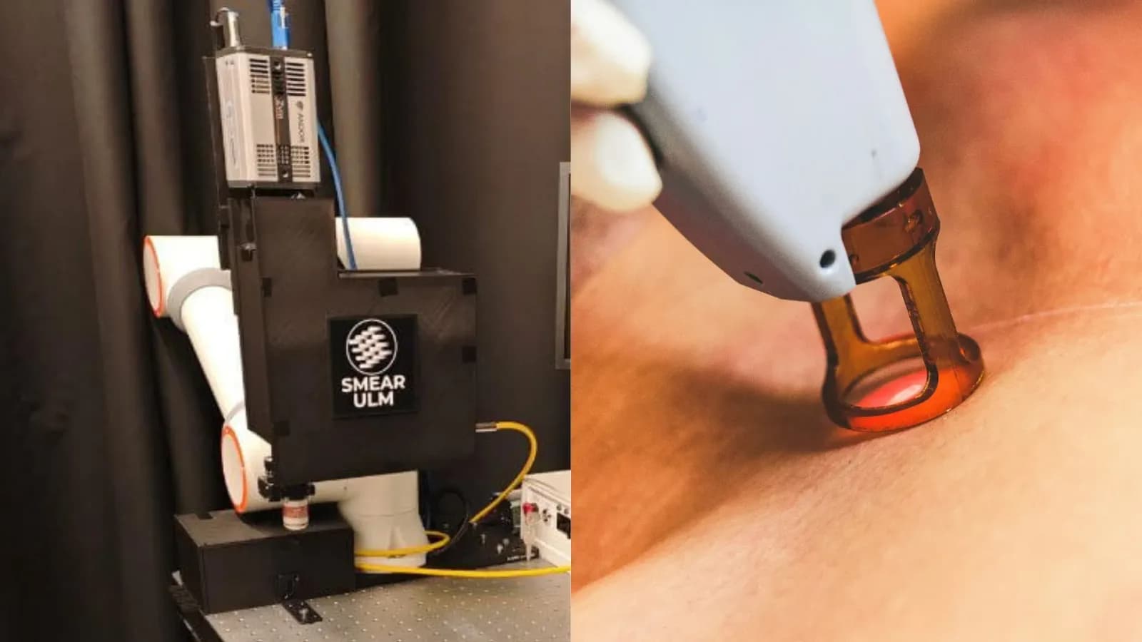 Neue intelligente Tätowierung erkennt Krebs durch Wärmesignale