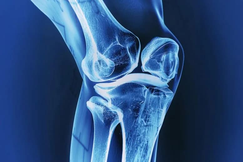Natürliche Verbindungen steigern den Erfolg von Knochenimplantaten, indem sie Bakterien und Krebszellen abtöten