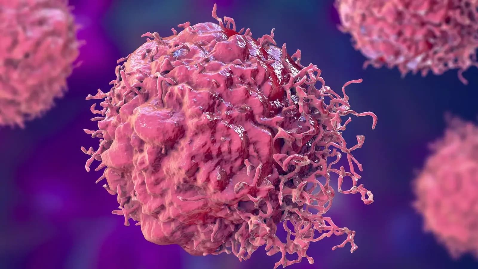 Kleiner Krebs-Screening-Test erkennt Tumore mit 94,9 % Genauigkeit frühzeitig