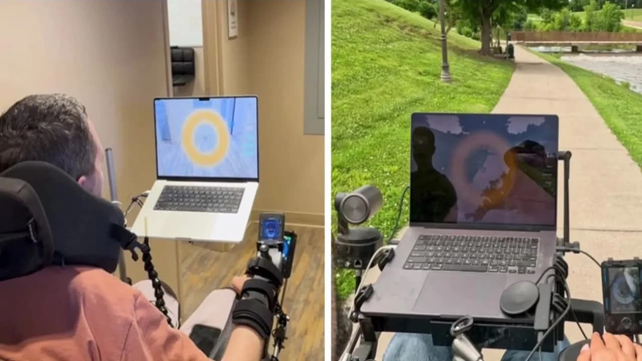Neuralink ermöglichte es gelähmten Teilnehmern, durch Gedankensteuerung Rollstühle zu bedienen.