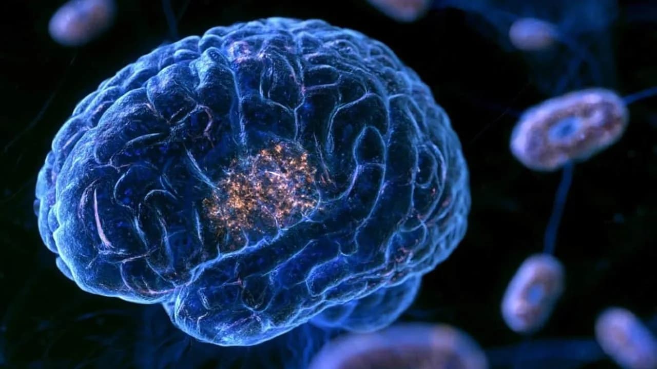Forscher entdecken neue intrazelluläre Plaques im Alzheimer-Gehirn
