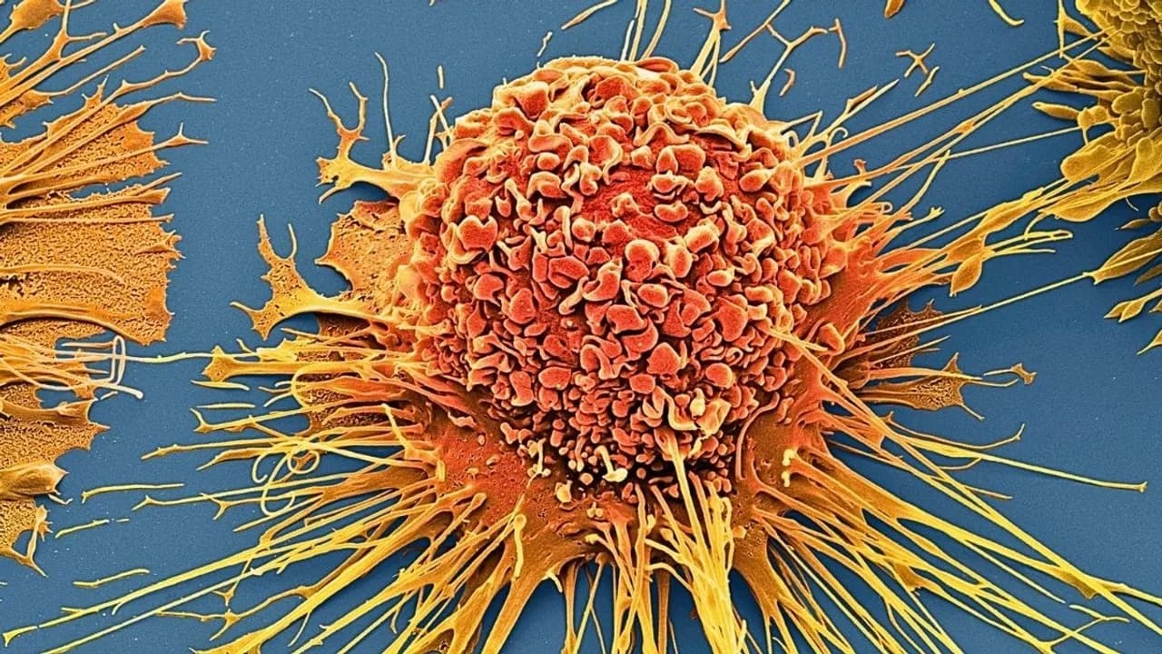 Wissenschaftler haben mit schwingenden Molekülen 99 Prozent der Krebszellen eliminiert