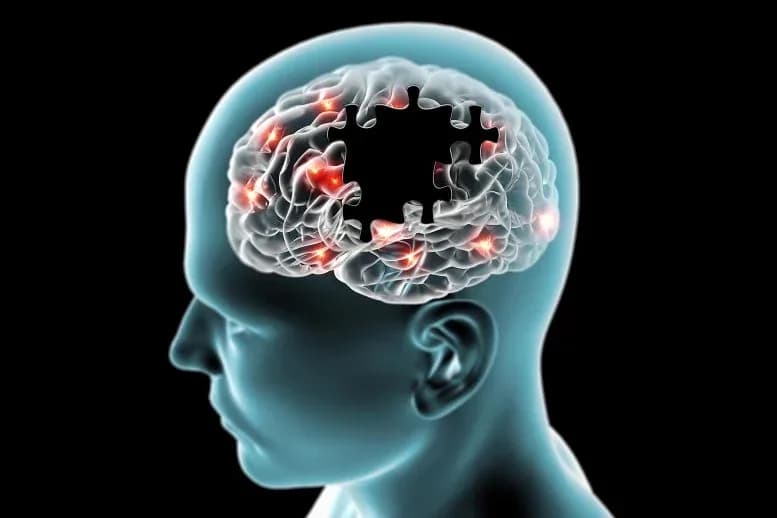 Forscher enthüllen: Fettleibigkeit kann Alzheimer auslösen