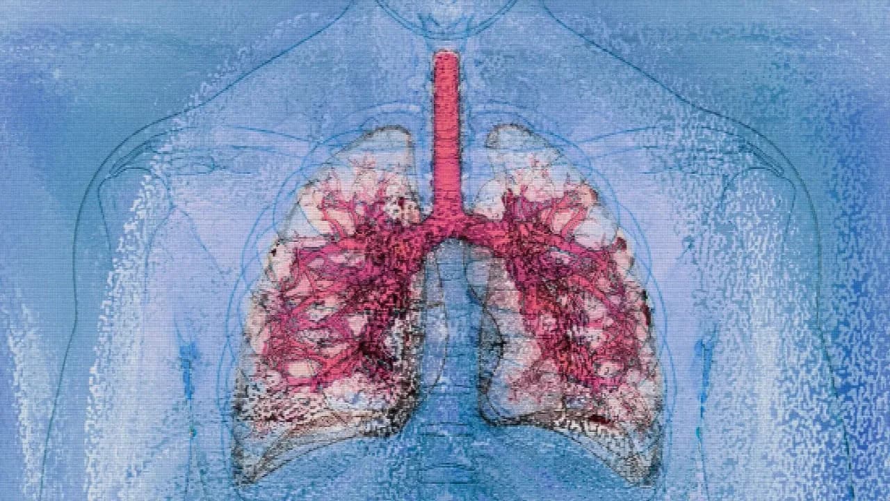 Medizinisches Meilenstein: Erfolgreiche Lungentransplantation und Lebertransplantation von HIV-positivem Spender