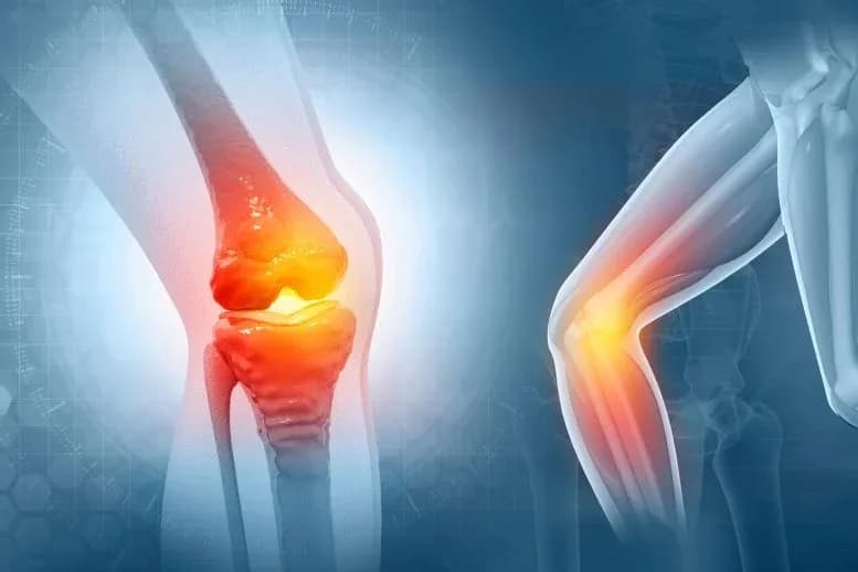 Neue Therapie könnte Arthrose innerhalb weniger Wochen umkehren