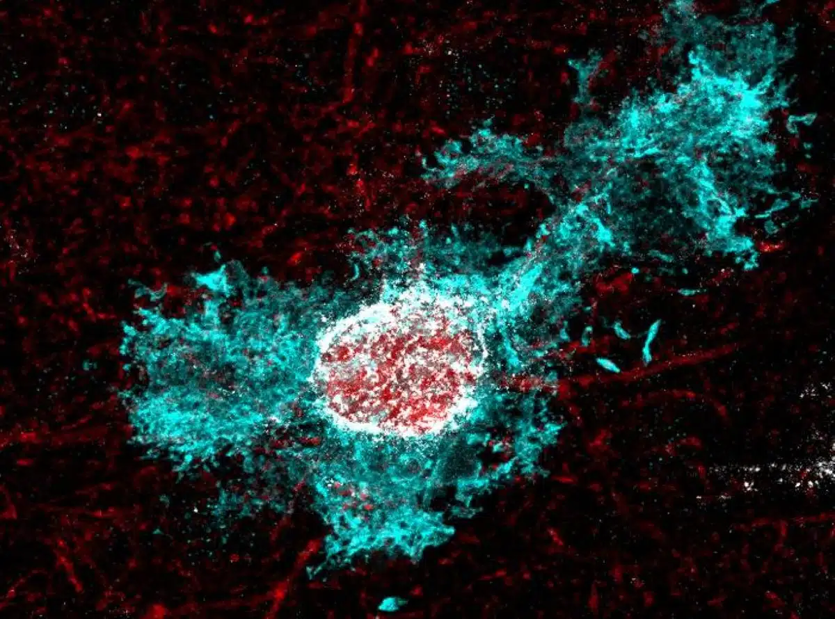 Neue Entdeckung: Cortisol-Signalweg beendet frühe Gehirnplastizität