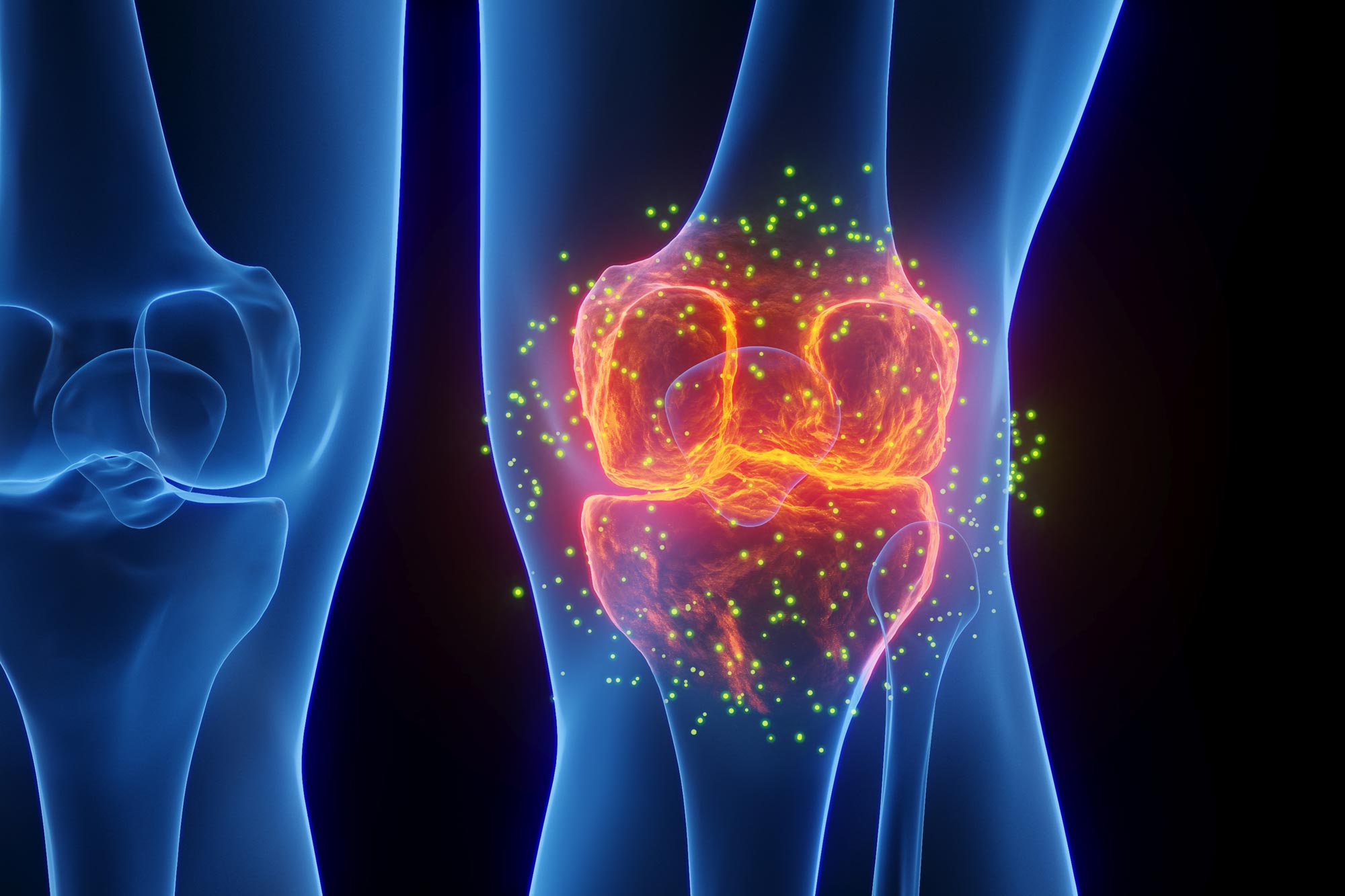 Überraschende Hormonentdeckung könnte die Behandlung von Arthritis revolutionieren