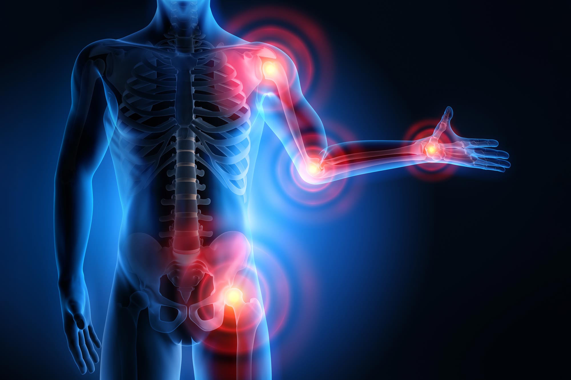 Vitamin-D-Mangel: Könnte er Ihre Schmerzen verstärken?