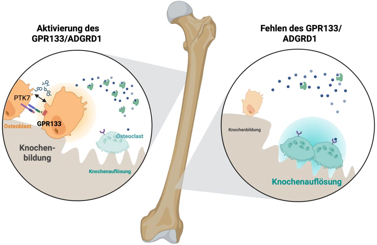 Entdeckung zur Knochenstärkung könnte Osteoporose umkehren