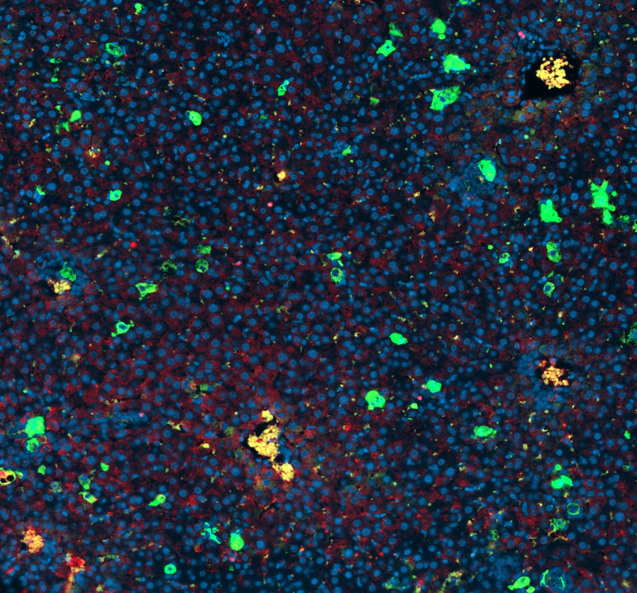Wissenschaftler entdecken tödliche Schwäche in „Zombie-Zellen“, die mit Krebs zusammenhängen