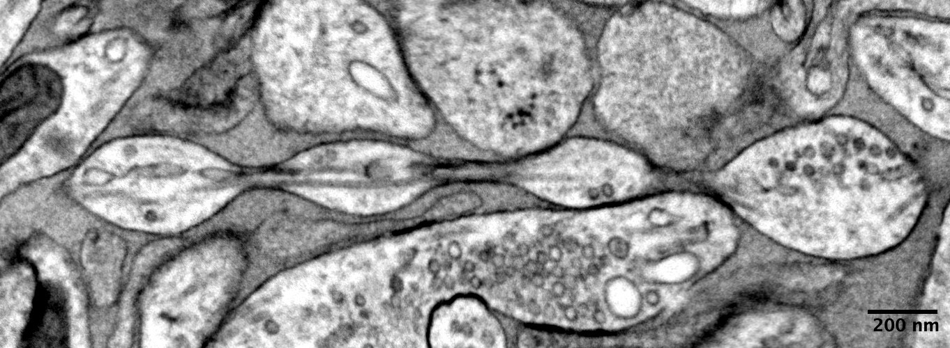 Wissenschaftler widerlegen 100 Jahre alte Annahme über Gehirnzellen und schreiben Lehrbücher neu