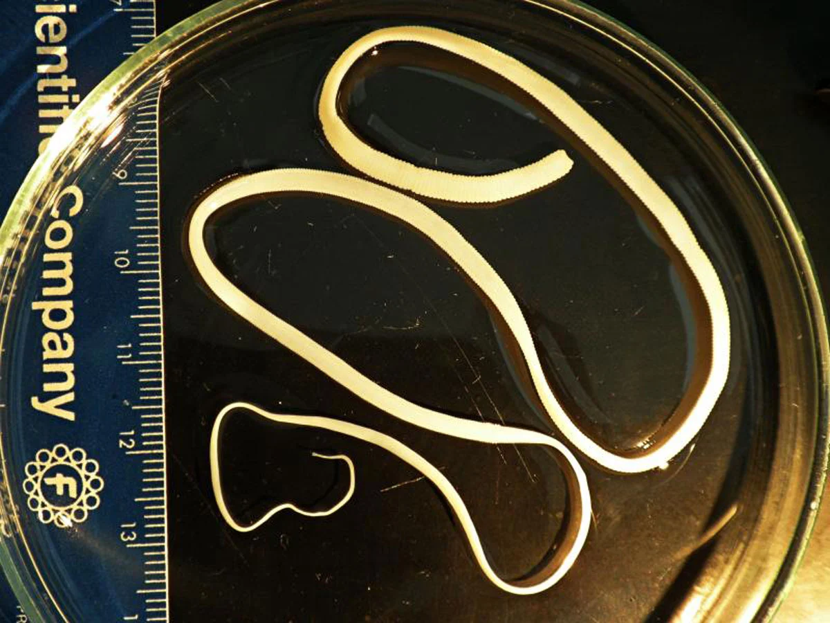 Die überraschende Ernährungsregel, die „gute“ Parasiten wirken lässt