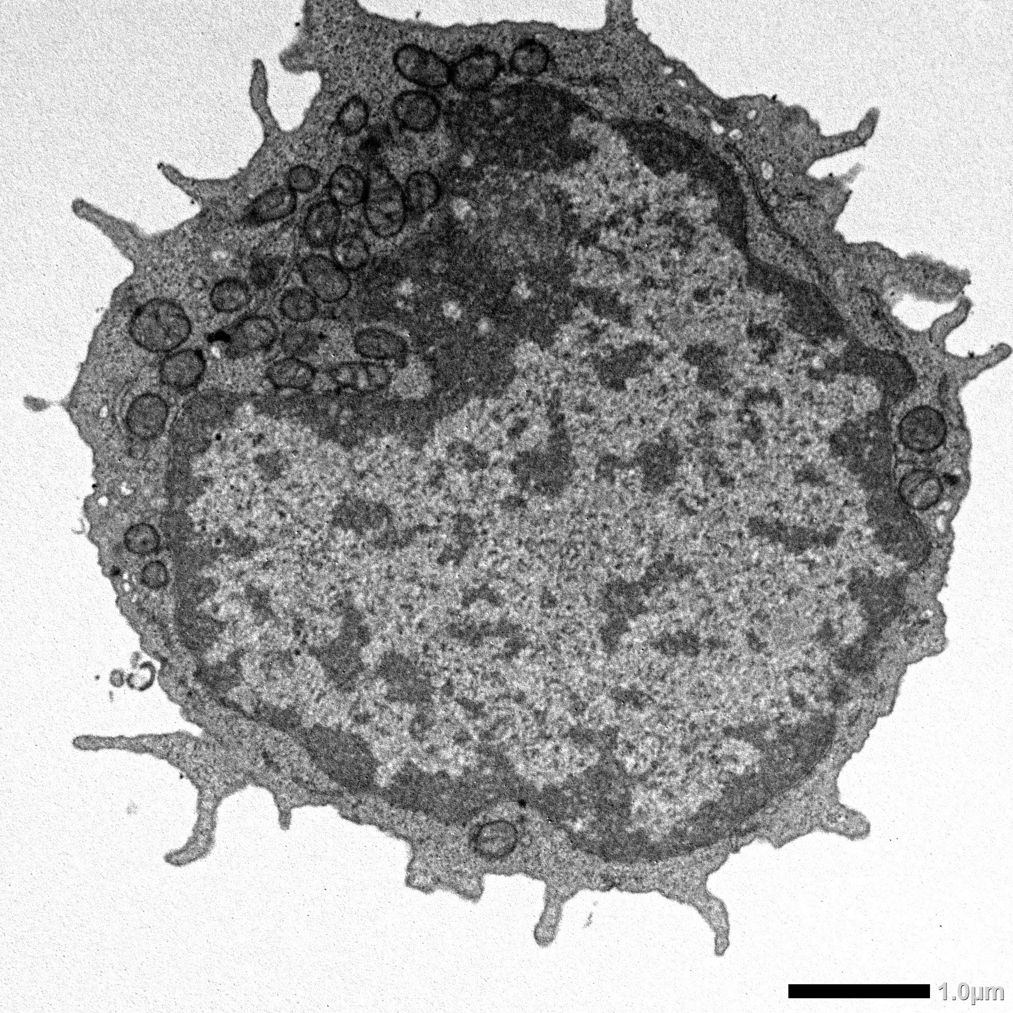 Wissenschaftler entdecken den verborgenen Auslöser der Stammzellenalterung