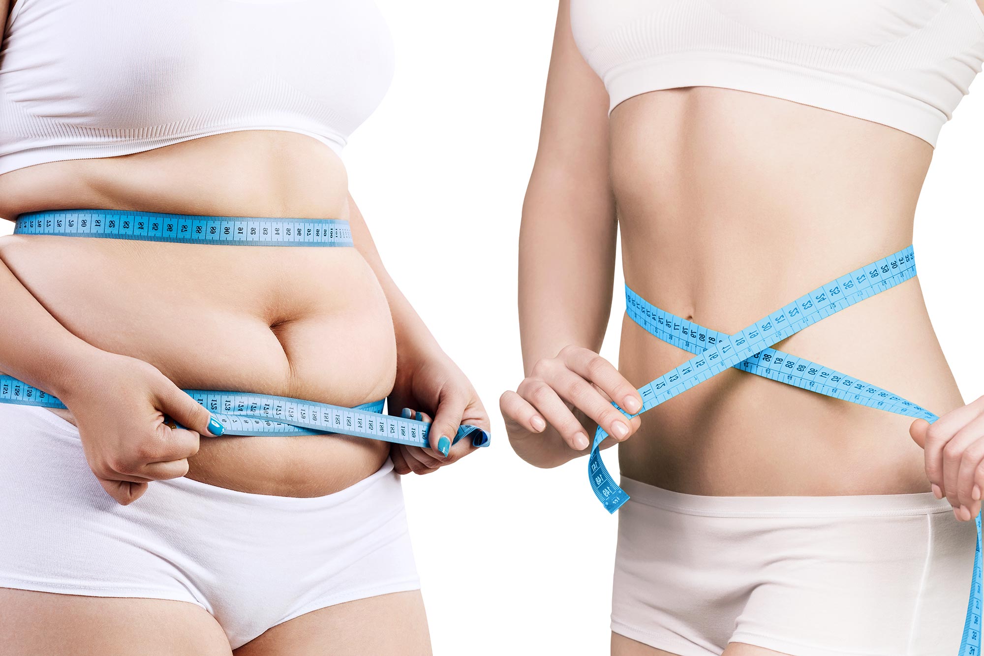 Warum Gewichtsverlust für alle Diabetes-Risikopatienten nicht ausreicht