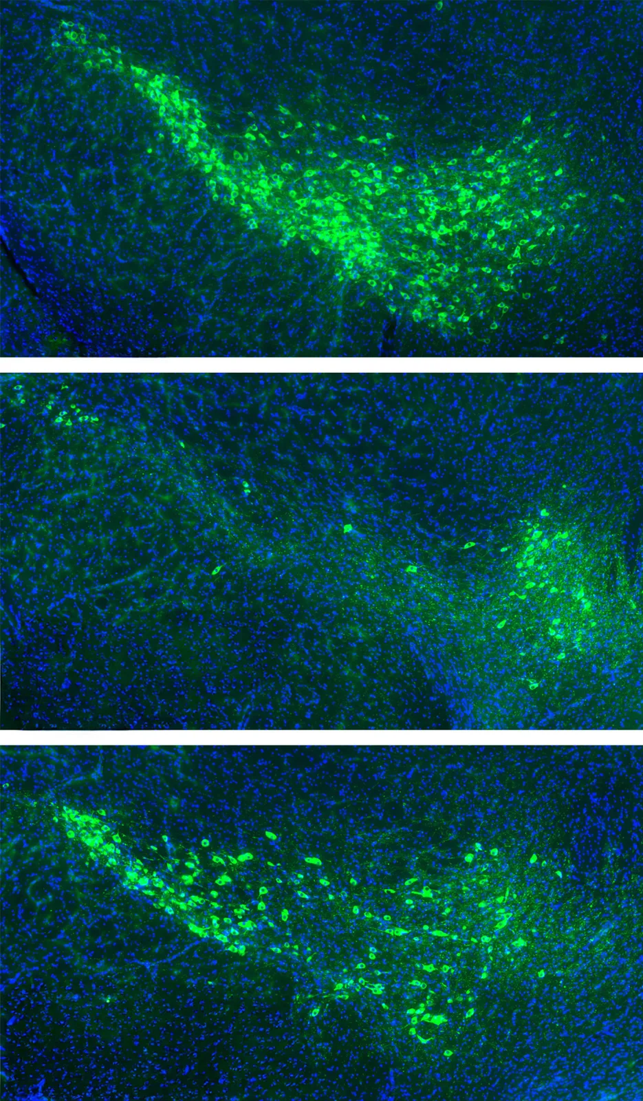 Forscher könnten Aufschluss darüber geben, wie sich Parkinson im Gehirn ausbreitet