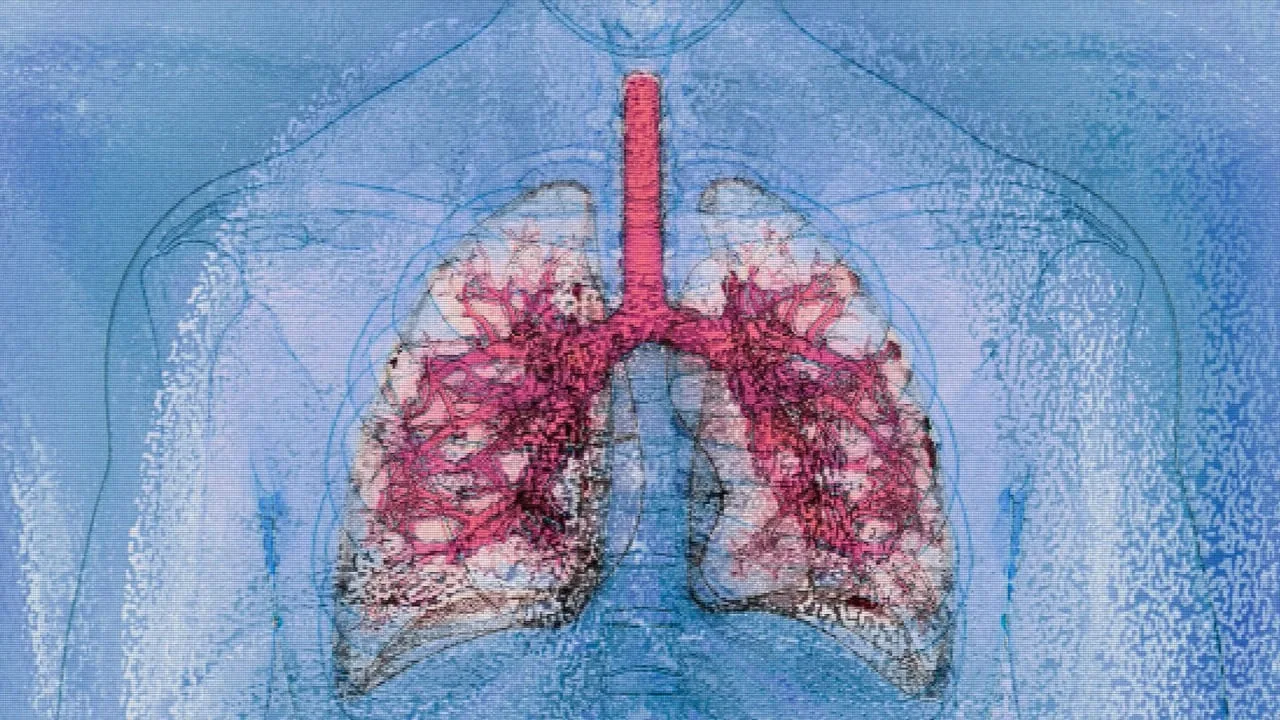 Medizinisches Meilenstein: Erfolgreiche Lungentransplantation und Lebertransplantation von HIV-positivem Spender
