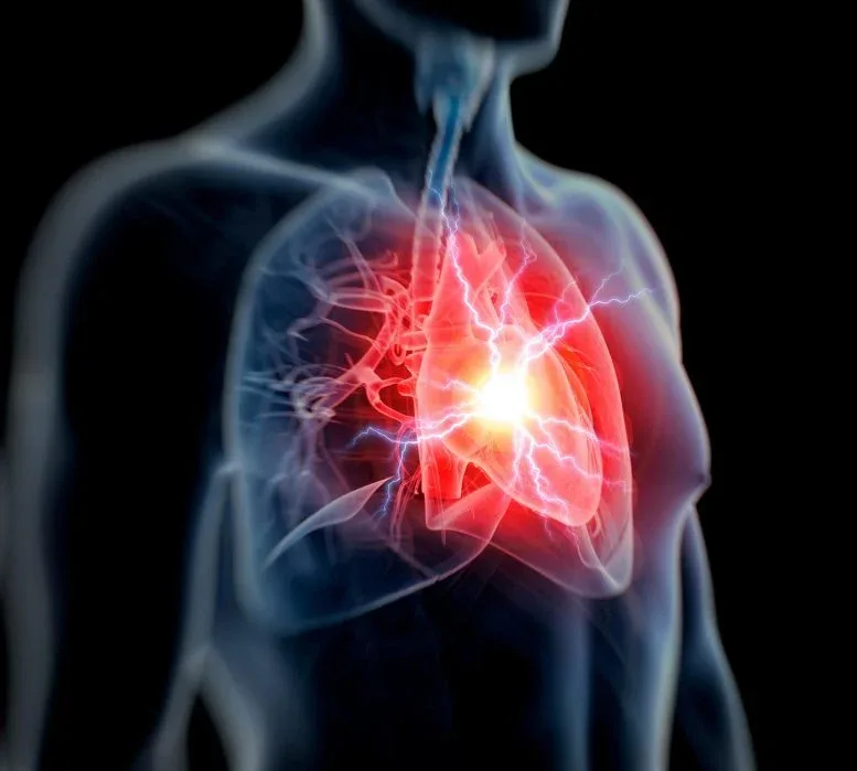 Hidden Heart Risk Found in 1 in 5 People, Study Warns