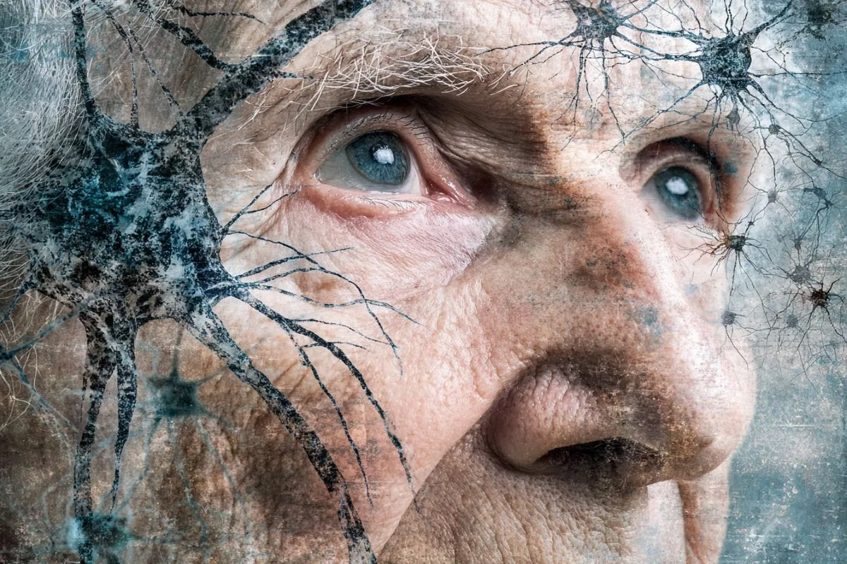 Parkinson’s Drug Restores Memories in Alzheimer’s