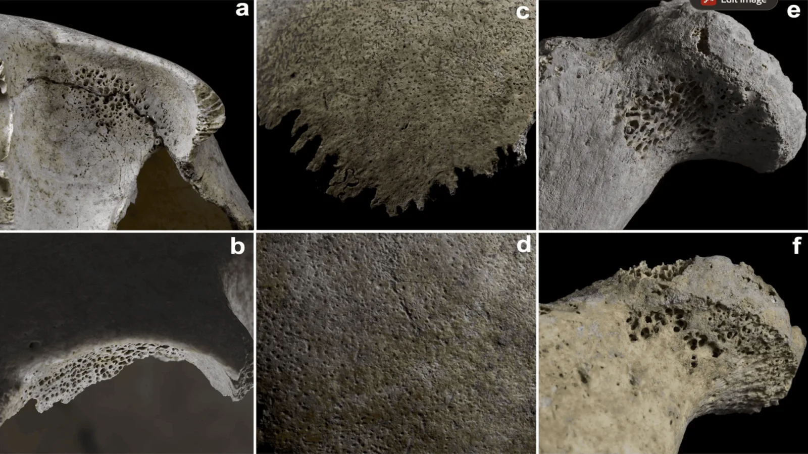 5,000-year-old mass grave reveals how diseases affected children