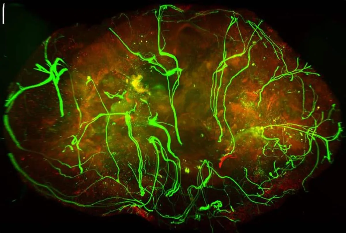 Mitfühlende Nerven verlangsamen das Melanomwachstum