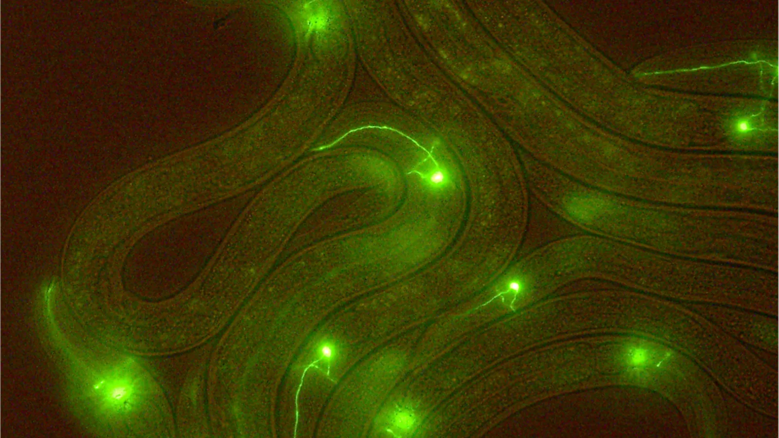 New imaging system cuts laser exposure, speeds 3D brain scans