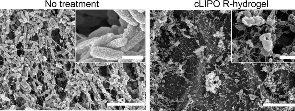 Wissenschaftler entwickeln intelligentes Verbandmaterial zur gezielten Bekämpfung schädlicher Bakterien
